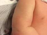 Девочки,подскажите сегодня у сына