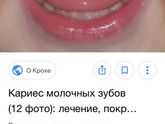 Зубы