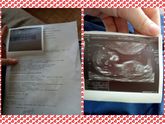 1 скрининг Гинекология и урология — ГАУ РС(Я) "Медицинский центр г. Якутска"