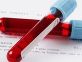 Анализ на толерантность к глюкозе🔴💉