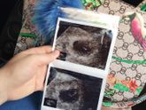Наше первое узи)))сердечко ❤️❤️❤️❤️Аллаха мин Шукур????????Срок поставили 6weeks1day