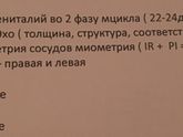Подскажите это обычное Узи ? Или нет