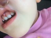 Незнаю что это может у кого так было ?