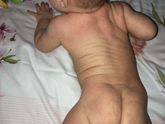 Аллергия или что другое?!