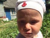 Я так понимаю алергия...