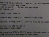 Предлежание плаценты