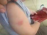Прививка