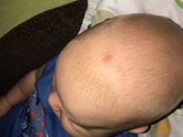 Это Камар укусил ??