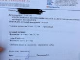 Фолликулометрия и овуляция