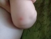 Что может быть?