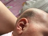 Аллергия не проходит !(