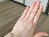 Отеки! Нужна ли госпитализация?!