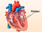 Дополнительная хорда в ❤️