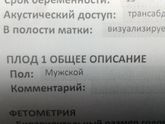 Мальчик!!!