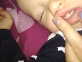 Девочки это кариес или гипоплазия?!? Завтра к врачу опять только к другому пойдем!!!