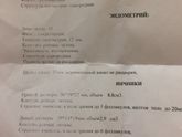 Девочки подскажите сделала Узи