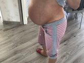 Посмотрите пожалуйста, опустился ли живот?