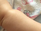 Сухое пятно на ручке