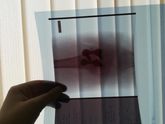 Вот такие пластины стоят теперь у нас в коленках, операция проведена 19.04.2018
