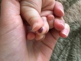 Прищемили палец!