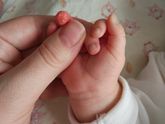 Вот так в Гемотесте мы сдали кровь из пальца