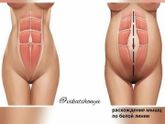 Можно ли качать пресс и делать немного приседаний