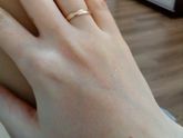 Шелушения и краснота на руках