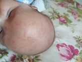 Всем привет,появились красные пятнышки