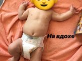 Рахит витамин Д
