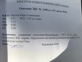 Отклонения на экг