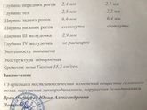 Нейросонография