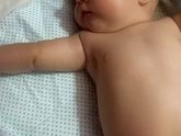Ребёнок выгибает руку. Помогите!