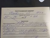 Гайморовы пазухи