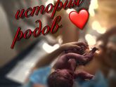 Моя история родов?