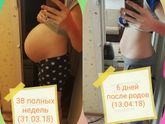 До и после родов (фотосравняшки)
