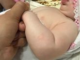 Раздражение на руке???