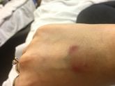 Как берут кровь у нас в больнице