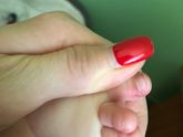 Нарывает пальчик