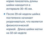 Длина шейка матки