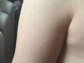 Аллергия или нет !