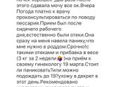 Отеки !!!