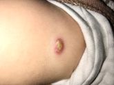 ‼️SOS‼️ РЕАКЦИЯ НА БЦЖ