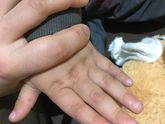 Девочки спасайте что это
