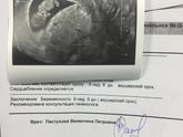УЗИ
