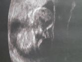 Мальчик 🤰💙