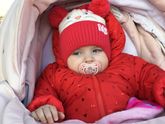 Синяки под глазами