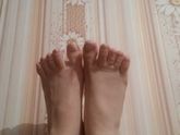 Отеки