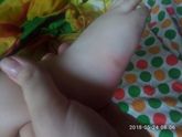 Уплотнение на ножке