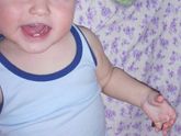 Моя Анкета 1 х родов ! 9.06.2012