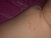 Аллергия. Введение прикорма